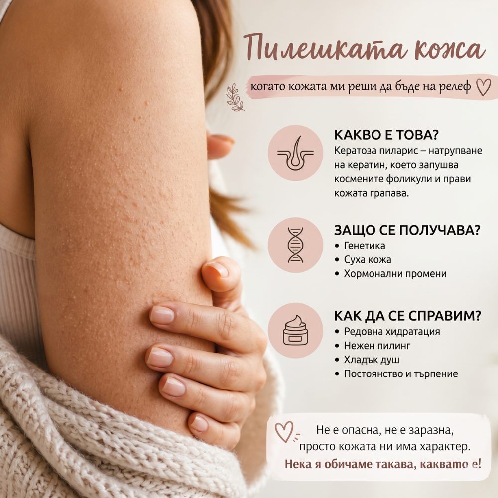 Пилешката кожа - когато кожата ми реши да бъде на релеф
